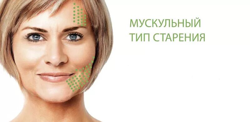 Мускульное лицо у женщин. Типы старения кожи. Мелкоморщинистый тип старения кожи. Деформационный морфотип. Мускульное лицо у женщин.
