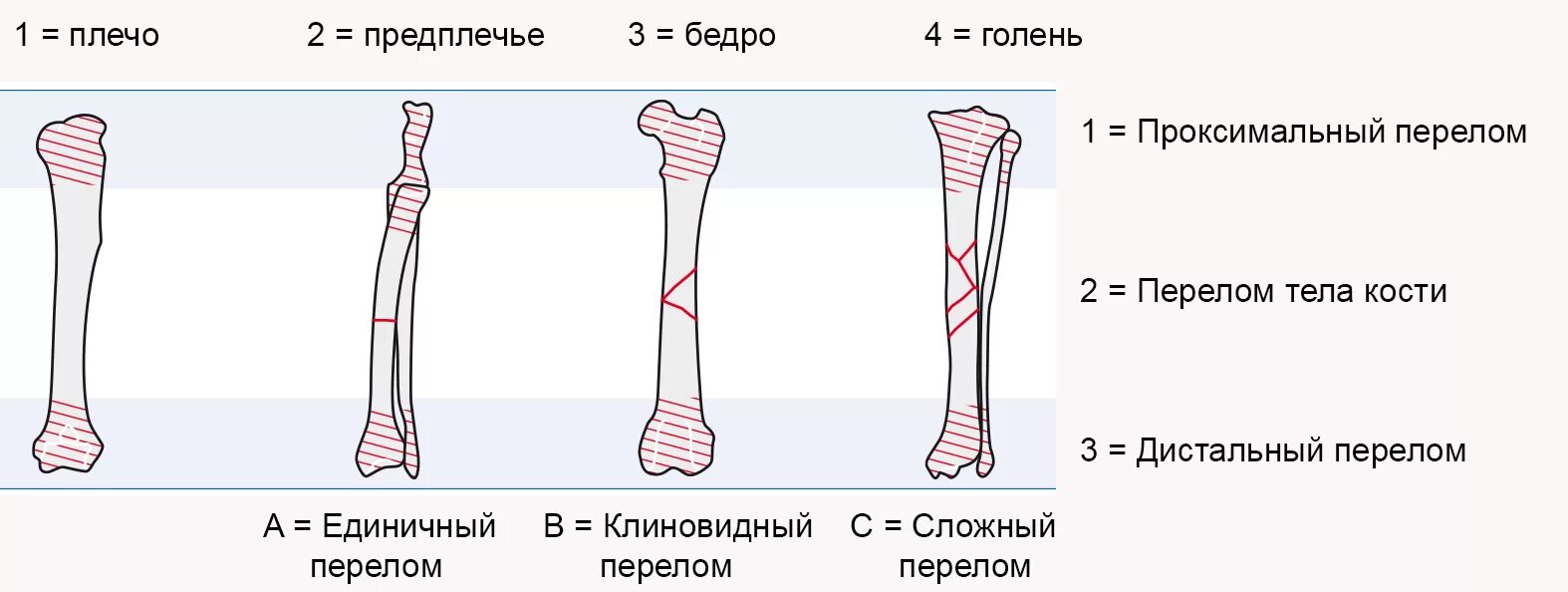 Степени открытого перелома. Классификация переломов костей конечностей. Классификация переломов большеберцовой кости собак. Классификация переломов бедренной кости. Классификация АО переломов плечевой кости.