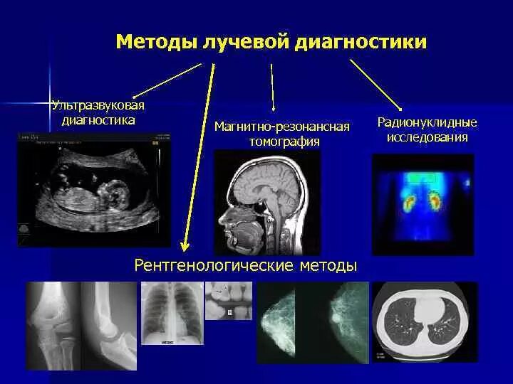Метод радиальных. Лучевая диагностика методы лучевой диагностики. рентгенологический способ лучевой диагностики. рентгеновский метод лучевая диагностика. методы исследования в лучевой диагностике.