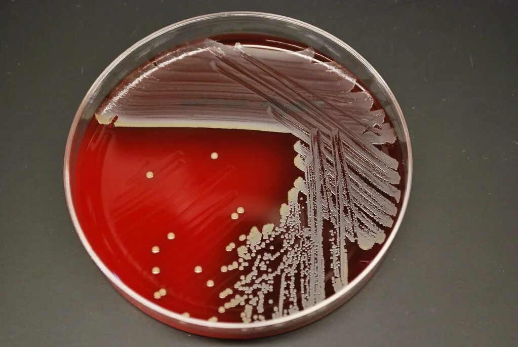 Staphylococcus aureus золотистый стафилококк. S. aureus золотистый стафилококк. Стрептококк ауреус. Стафилококк ауреус под микроскопом. Стафилококк ауреус микробиология.