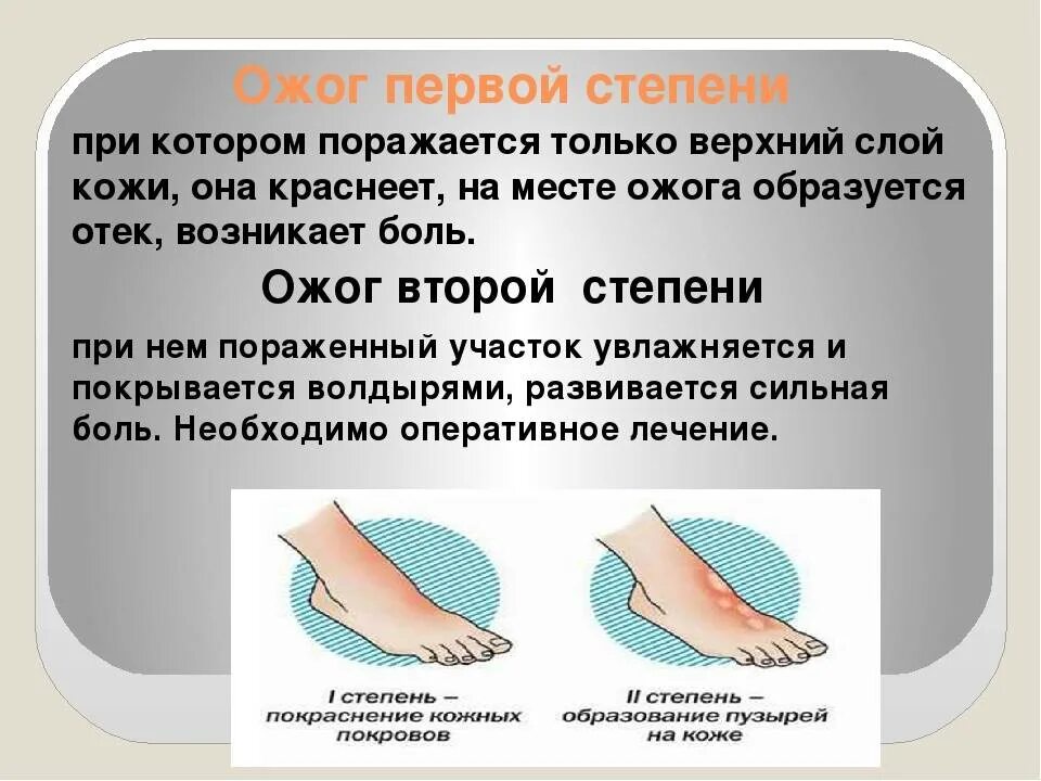 Первая степень при ожоге 1 степени. Термический ожог степени. От ожогов в домашних условиях средство кипятком