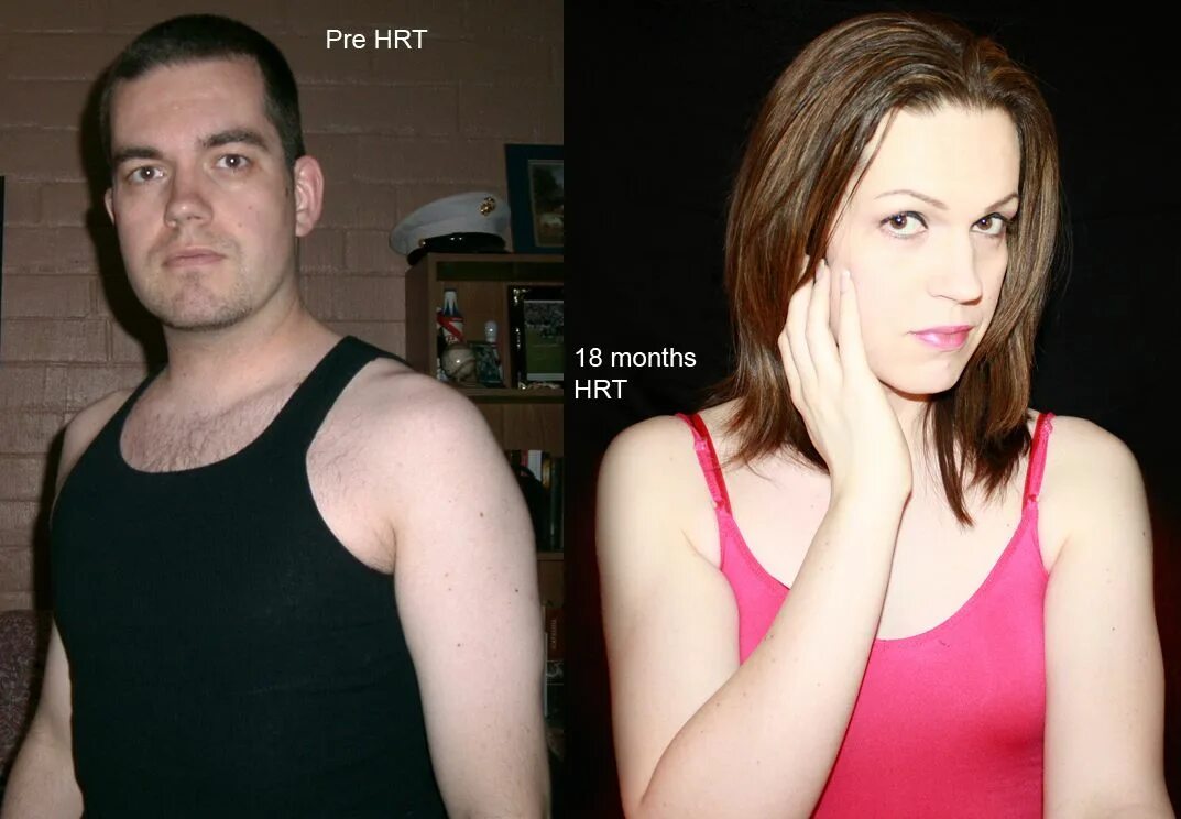 My before