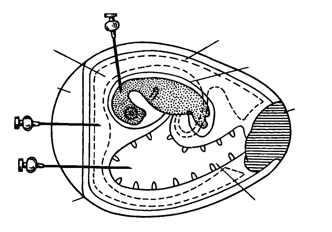 Культивирование на куриных эмбрионах. Метод куриного эмбриона. Метод куриного эмбриона. Недостатки метода культивирования вирусов в куриных эмбрионах. Этапы заражения куриного эмбриона вирусом.