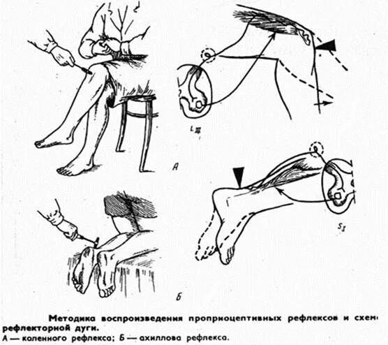 Схема рефлекторной дуги ахиллова рефлекса. Схема дуги ахиллова рефлекса. Ахиллов рефлекс схема рефлекторной дуги. Схема рефлекторной дуги ахиллова рефлекса 5 звеньев.