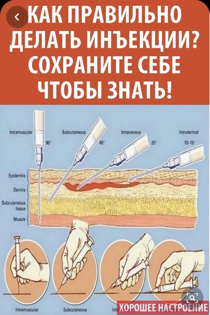 Глубина иглы при внутримышечной инъекции. Какправильно лноать ккол. Какаравильно делать укол. Как правильно делать укол. Как правильно делать УК.