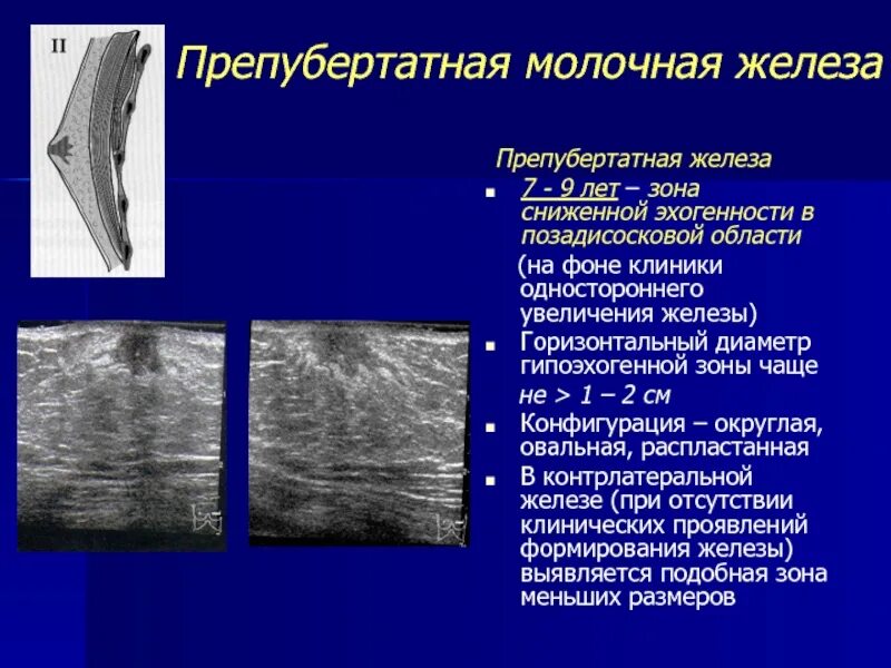 Строение молочной железы на УЗИ. Эхогенность железистой ткани молочной железы. Эхогенность лимфоузлов снижена. Типы строения молочной железы УЗИ. Увеличен лимфоузел в молочной железе