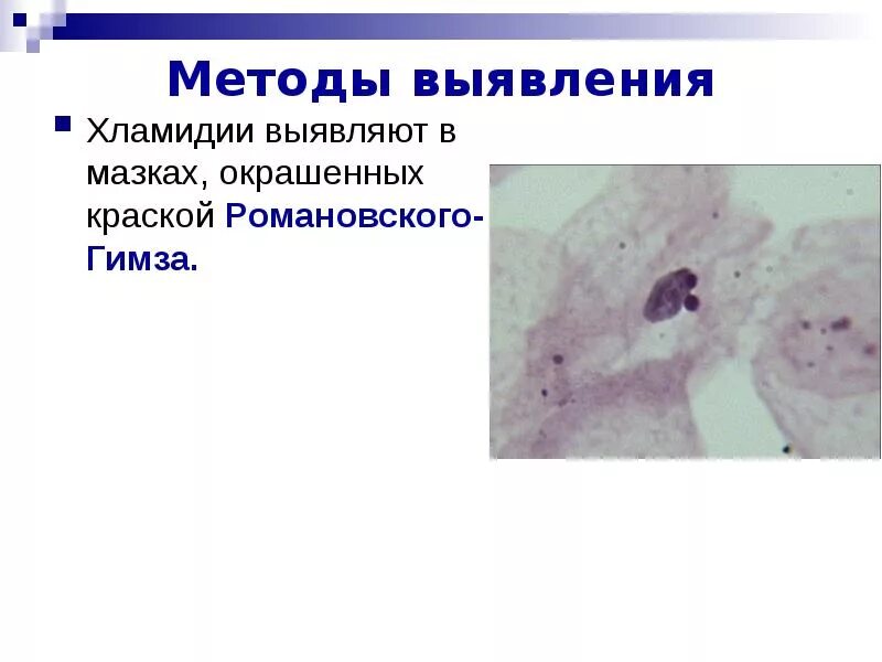 Trichomonas vaginalis под микроскопом. Гонорея патоморфология. Метод романовского-гимза хламидии. Влагалищная трихомонада заражение. Гонорея внутриклеточная.