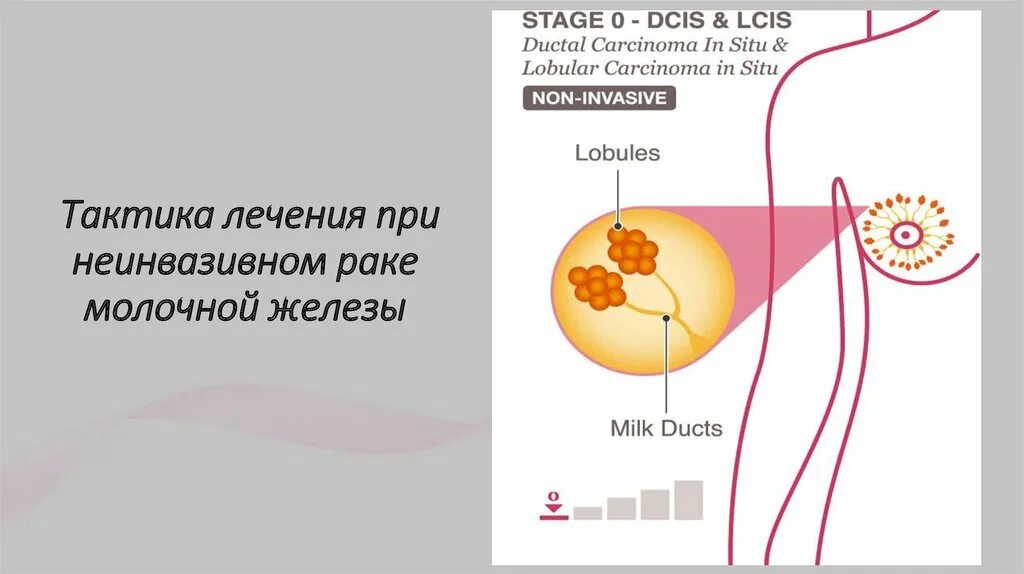 Жизнь при раке молочной железы. Неинвазивная опухоль молочной железы что это. обработка опухоли молочной железы. лекарства против опухолей молочной железы. места расположения опухоли молочной железы.