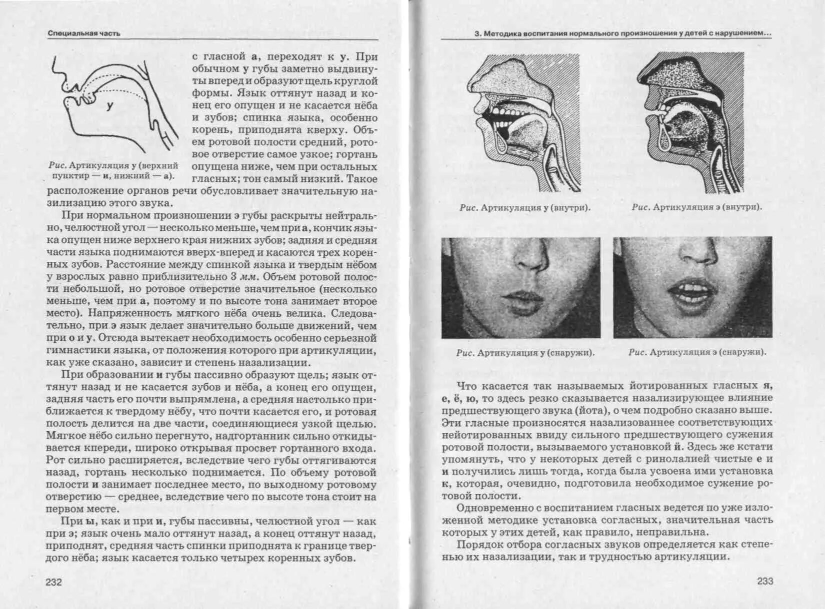 Язык во рту в спокойном состоянии. Правильное положение языка во рту. Положение языка при ринолалии. Нормальное положение языка.