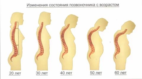 Может ли в течении жизни измениться