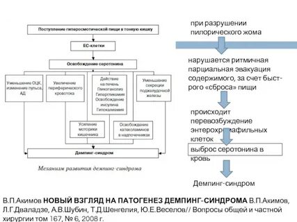 Демпинг синдром