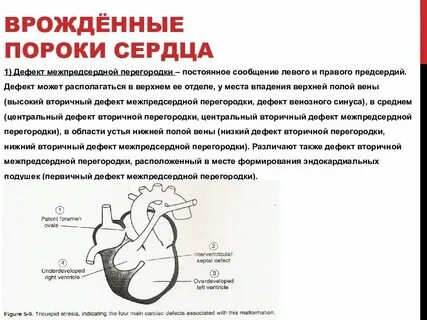 Код мкб дмпп у детей