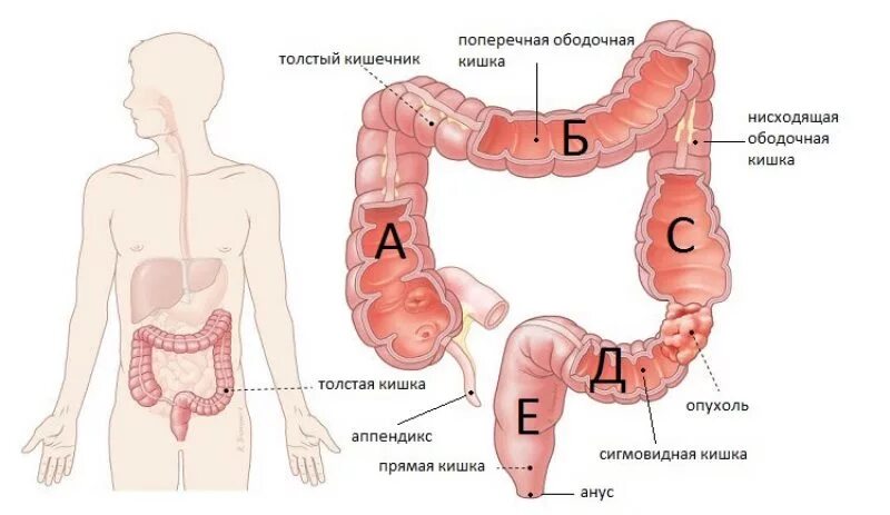 Сигмовидная кишка где находится и симптомы. Поперечно ободочный отдел толстой кишки. болезнь крона сигмовидной кишки. поперечно-ободочеая поперечно-ободочная кишка. поперечный отдел ободочной кишки.