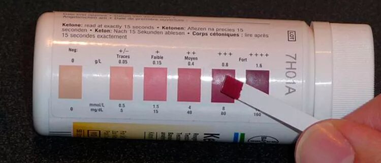 Кетоны в моче у мужчины. 1.5 Ммоль кетонов в моче. Ацетон в моче 2 ммоль/л. Ацетон в моче 8 ммоль/л. Полоски для измерения ацетона в моче.