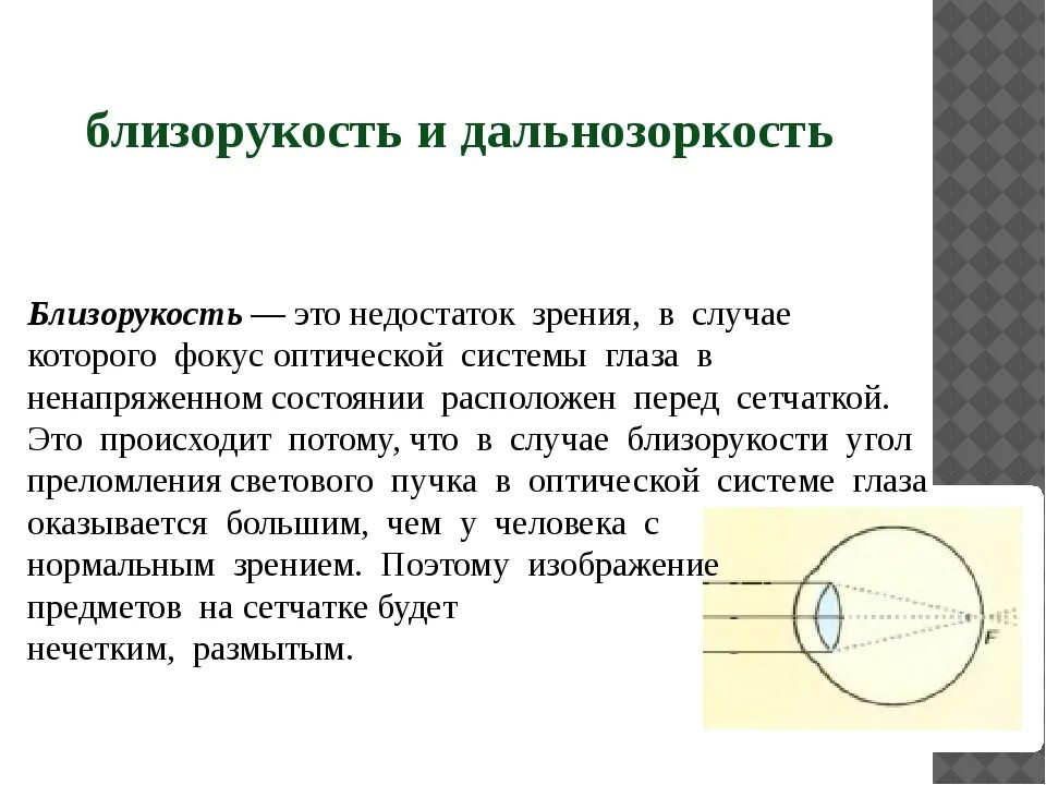 Недостатки оптической системы глаза. Оптическая система глаза дефекты зрения. Недостатки оптической системы глаза и их компенсация. Близорукость это недостаток глаза, состоящий в том, что:. Перед сетчаткой расположена