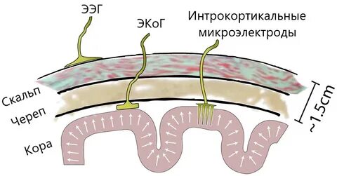 Ecog