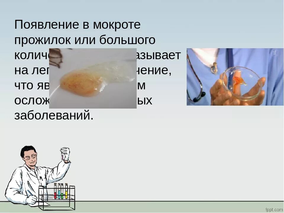 Почему утром мокрота. Прожилки крови в мокроте. Мокрота с прожилками крови. Кровь при отхаркивании мокроты. Цвета мокроты при различных заболеваниях.
