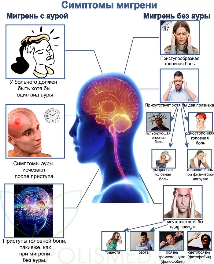 Мигрень. Симптоматика мигрени. Мигрень проявления. Симптомов появление головной