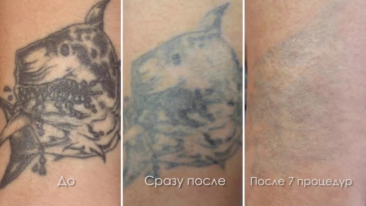 Сразу после 100. Сразу после 100