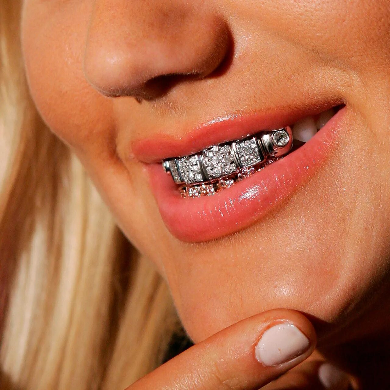 золотой зуб блестит