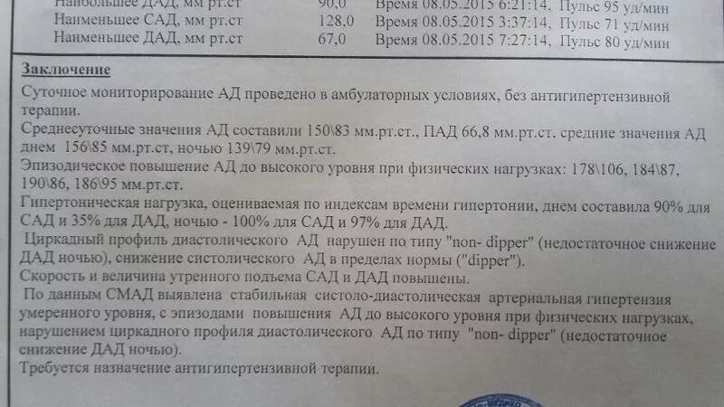 Образец холтеровского мониторирования