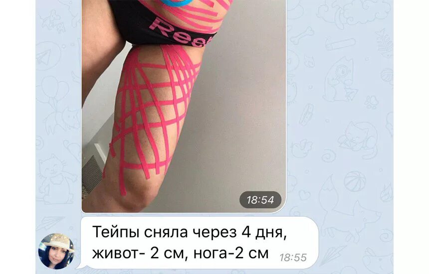 тейпы для лица схемы. тейпирование для похудения схемы. тейпирование живота для похудения. тейпирование для похудения схемы. тейпирование от целлюлита схемы.