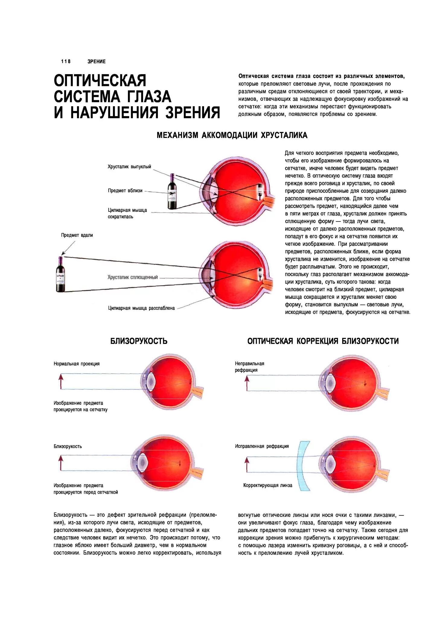 Что фокусирует изображение на сетчатку. Формирование изображения предметов в оптической системе глаза. фокусирует изображение на сетчатку.
