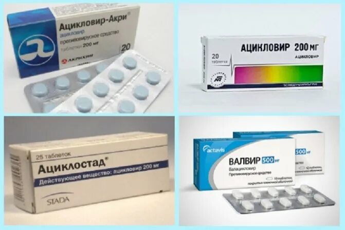Таблетки от герпеса. Мазь и таблетки от герпеса. Противовирусная терапия герпеса. Таблетки от герпеса опоясывающего лишая. Лекарство от герпеса.