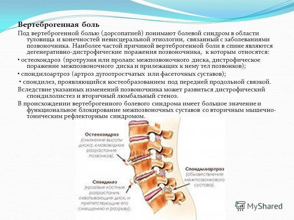 Вертеброгенная дорсалгия. Цервикалгия люмбалгия. Синдром цервикалгии шейный отдел. Остеохондроз поясничного отдела позвоночника синдромы. Остеохондроз вертеброгенная люмбалгия.