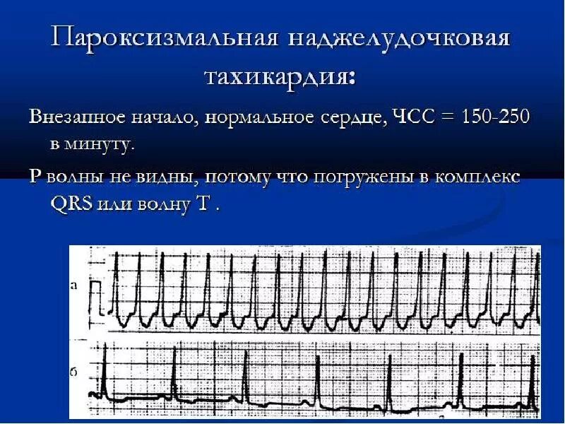 Чсс 140
