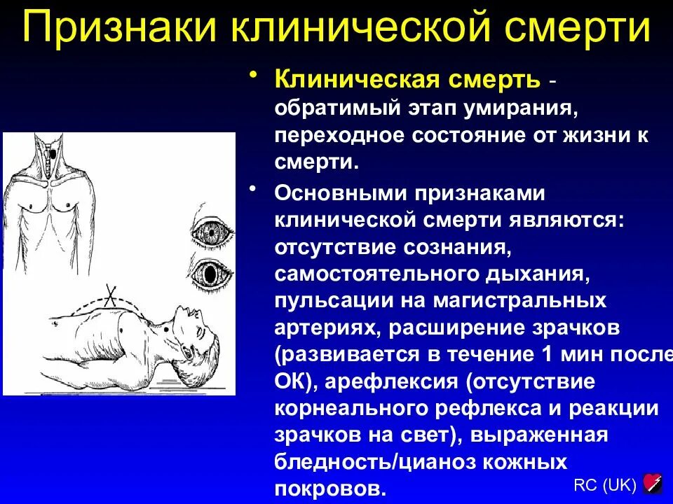 Жизнь после клинической. Состояние клинической смерти. Признаки жизни и клинической смерти. Этапы наступления клинической смерти.