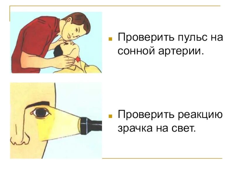 Зрачки и пульс проверить. Проверить пульс на сонной артерии. проверка реакции зрачков на свет. проверить реакцию зрачков на свет и пульс на сонной артерии. убедиться в наличии пульса на сонной артерии.