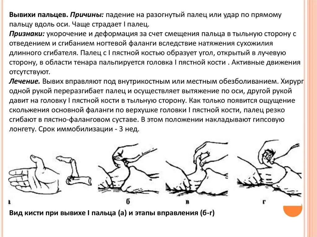 Как правильно вставлять пальцы. Вправление вывиха пальца кисти. Вправление вывиха пальца. Вправление суставов на пальцах. Вывих первого пальца вправление.