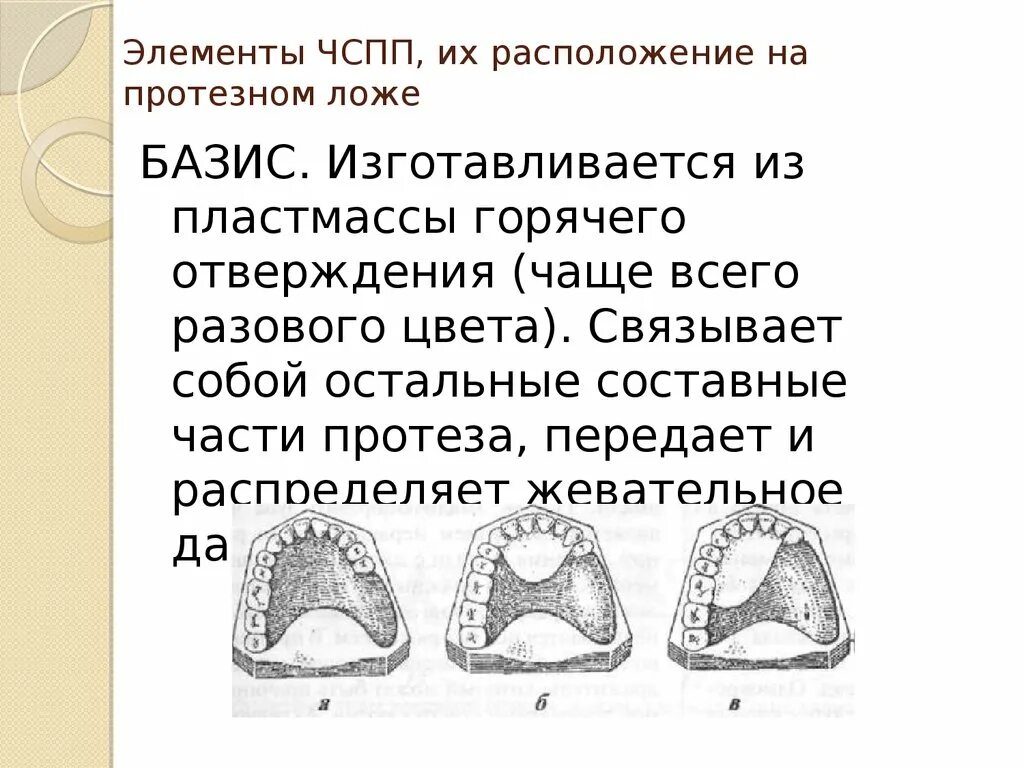 Толщина базиса. Элементы частичного съемного пластиночного протеза. Конструктивные элементы частичного съемного пластиночного протеза. Конструктивные элементы съемных пластиночных протезов.