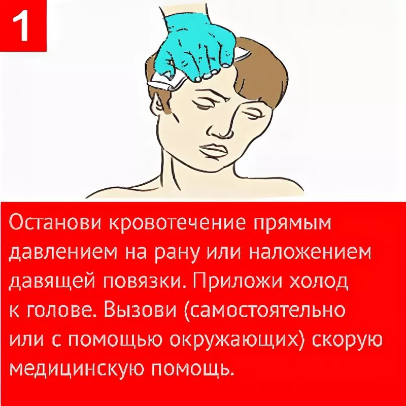 Помощь при ранениях головы. Первая помощь при травме головы. Ранение волосистой части головы первая помощь.