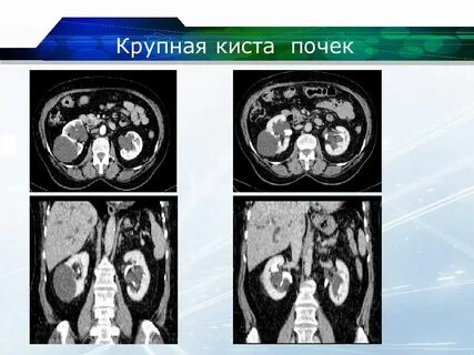 Куста почек