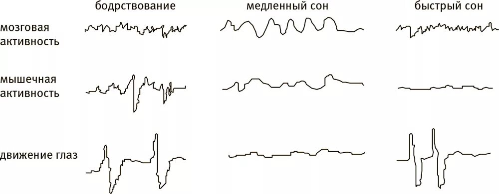 Сон человека медленный и быстрый. Фазы быстрого и медленного сна. Электроэнцефалограмма быстрого и медленного сна. Быстрая фаза и медленная фаза сна. Медленная и быстрая фазы СН.