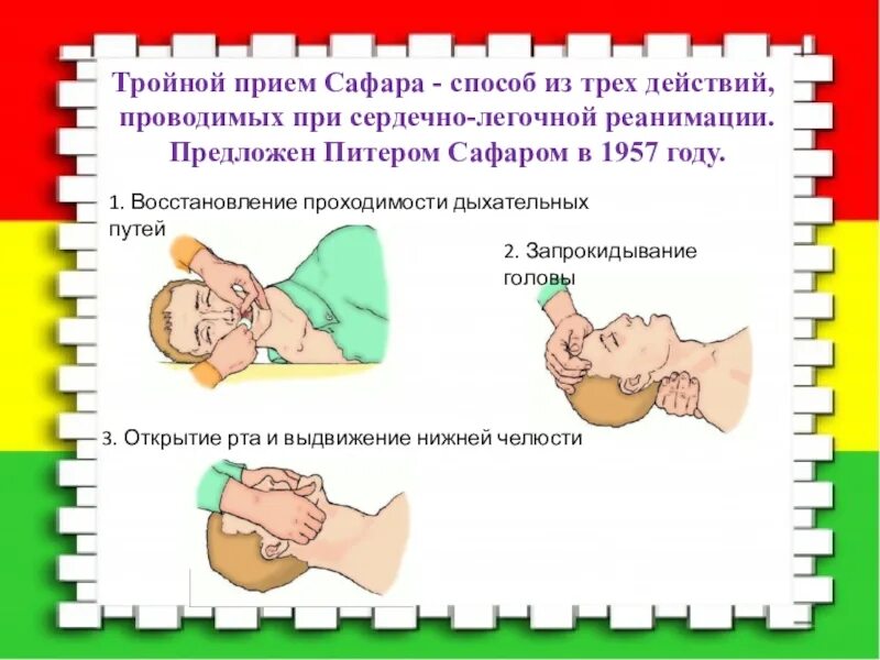 Тройной прием алгоритм. Тройной прием Питера Сафара. Сердечно легочная реанимация тройной прием Сафара. Тройной прием сердечно-легочной реанимации.