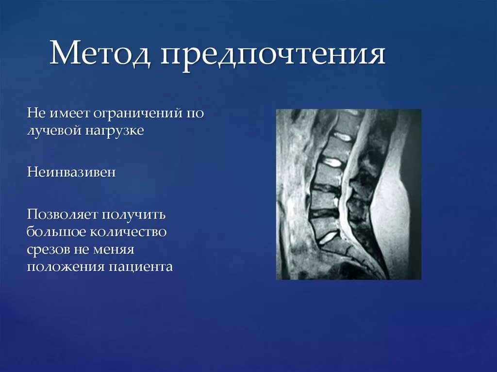 Метод предпочтений. Метод предпочтения. метод предпочтения пример решения. лучевая нагрузка при мрт позвоночника. виды срезов лучевая диагностика.