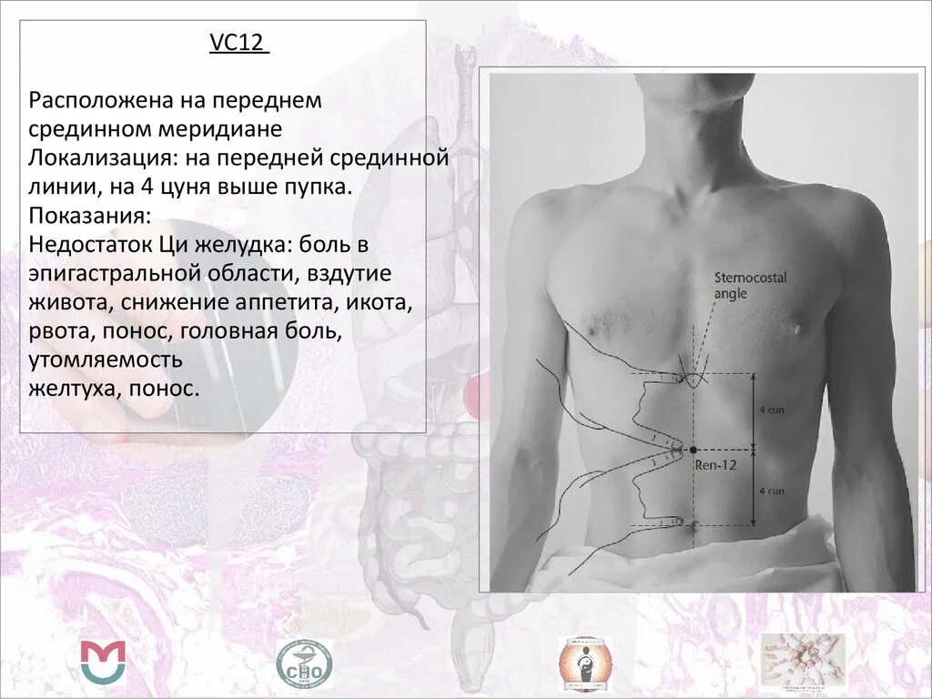 Боли в области желудка вздутие живота. Эпигастральная область. Вздутие в эпигастральной области. Болит в эпигастральной области. Эпигастральная область желудка.