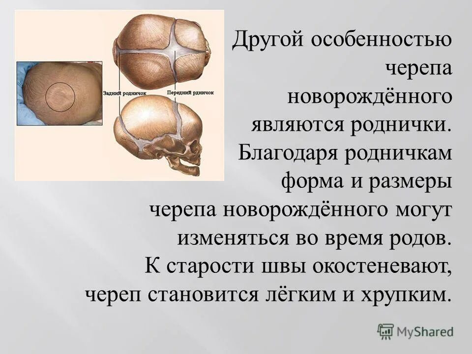 Роднички функции родничков. Роднички черепа новорожденного. Швы и роднички черепа новорожденного. Череп в целом швы и роднички.