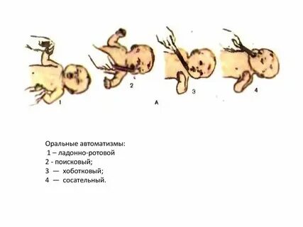 Автоматизмы новорожденных
