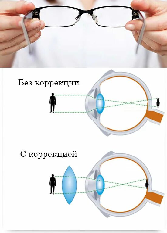 Дальнозоркость что делать. Исправление дальнозоркости. Принципы коррекции пресбиопии. Старческая гиперметропия. Дальнозоркость и пресбиопия.