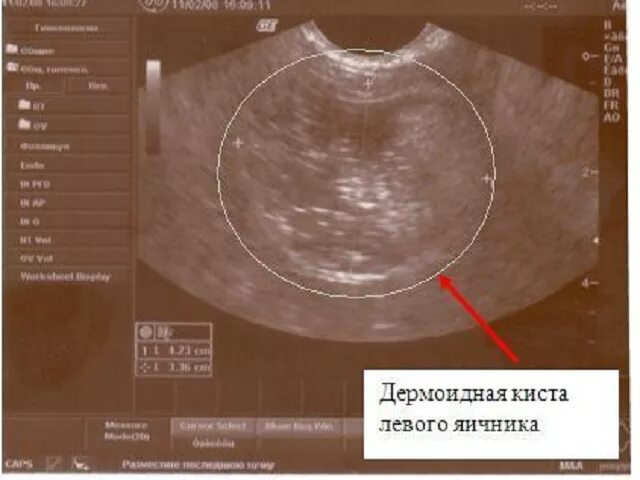 можно ли при хондрозе принимать горячую ванну. баня от болей в спине. в бане женской и мужской. давление в бане. в.