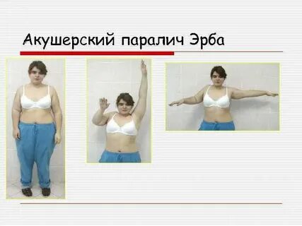 Частичный или полный паралич