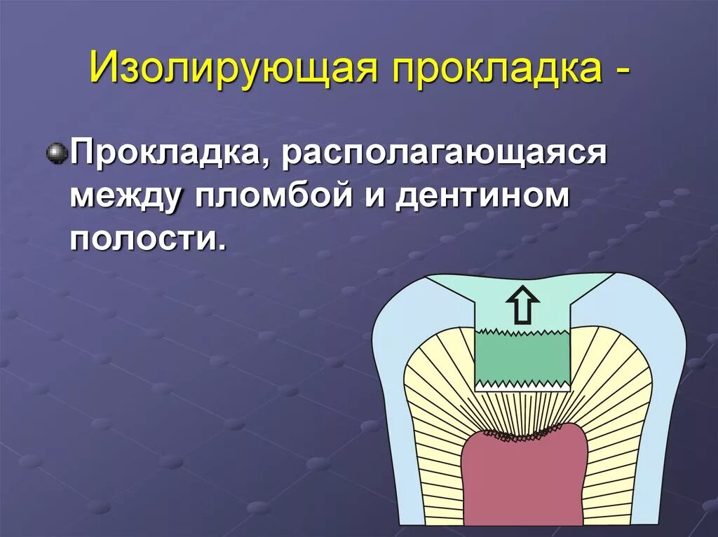 Зачем изолируют. Изолирующая прокладка в стоматологии материалы. Наложение лечебной прокладки в стоматологии. Изолирующие подкладки в стоматологии. Изолирующая прокладка Vitrebond.