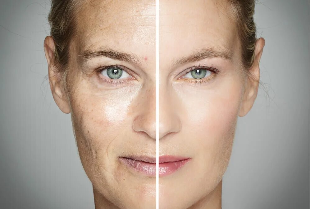 Aging filter