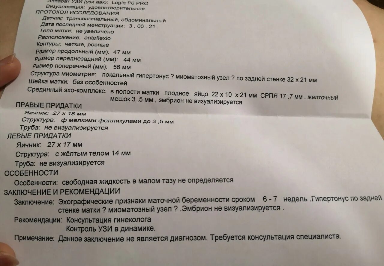 Размер плодного яйца на 5 неделе. Диаметр плодного яйца на 5 неделе. Плодное яйцо СВД 3.5 мм. Размер плодного яйца 9 мм. Не видно плодного яйца на 5 неделе