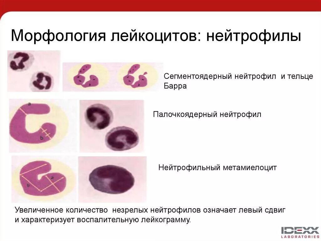 Палочкоядерные нейтрофилы микроскопия. Нейтрофилы палочкоядерные 7. Нормы сегментоядерных нейтрофилов у детей. Нейтрофилы палочкоядерные 7. Функции палочкоядерных нейтрофилов.