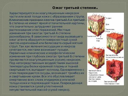 Iii степень